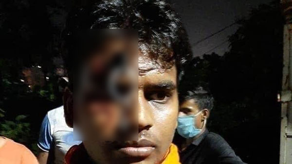 హెల్మెట్ ధరించనందుకు నుదుటిపై బైక్ కీ తో పొడిచిన పోలీస్, తర్వాత ఏం జరిగిందంటే