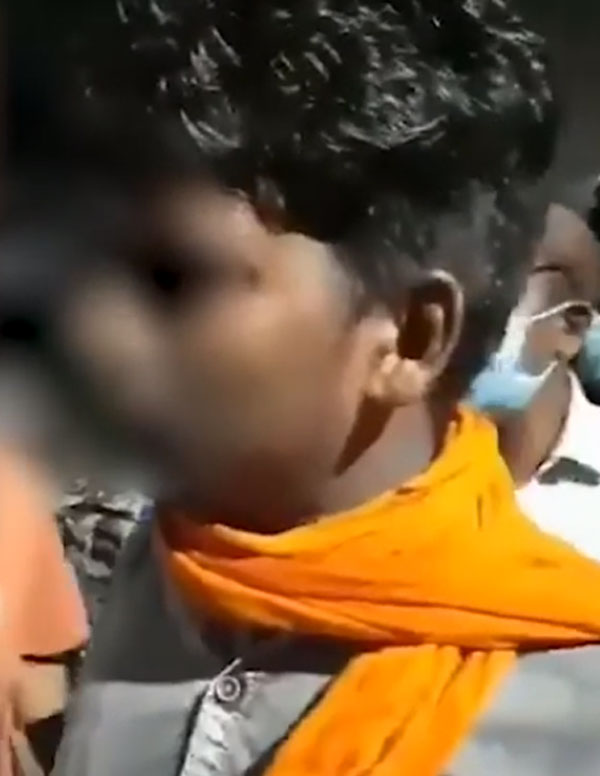 హెల్మెట్ ధరించనందుకు నుదుటిపై బైక్ కీ తో పొడిచిన పోలీస్, తర్వాత ఏం జరిగిందంటే